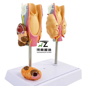 Modelos de Patología de la Tiroides para Enseñanza Médica, Exhibición de Enfermedades de la Tiroides para Anatomía Médica - Product Image 5