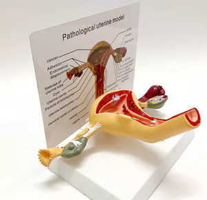 Modèle anatomique de l'utérus <span class=keywords><strong>humain</strong></span> en PVC de haute qualité, structure pathologique gynécologique, organes reproducteurs féminins pour l'enseignement CE/ISO - Product Image 5