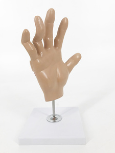 Ciencia médica Mano Articulación Inflamación Lesiones <span class=keywords><strong>de</strong></span> las manos Anatomía patológica Huesos Nervios Músculos Mano Anatomía Modelo <span class=keywords><strong>de</strong></span> enseñanza - Product Image 5