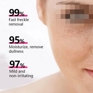 Crème éclaircissante pour les taches de rousseur, élimine les taches brunes, atténue le mélasma, réduit la mélanine, améliore l'<span class=keywords><strong>anti</strong></span>-<span class=keywords><strong>pigmentation</strong></span> pour le visage, crème lotion cosmétique - Product Image 3
