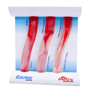 Mô hình trình diễn bệnh lý mạch máu LDL mô hình Tài Nguyên giảng dạy mạch máu xơ vữa động mạch - Product Image 1