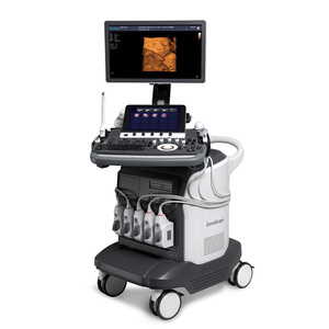 Chariot médical intelligent S50elite, appareil d'échographie 3D 4D avec fonction IA pour obstétrique et gynécologie, appareil d'échographie S50elite - Product Image 5