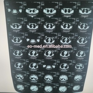 Imprimante thermique portable à prix abordable pour films radiographiques secs, compatible avec les appareils de radiographie XP01 - Product Image 6