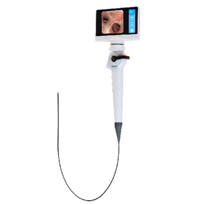 Broncoscópio Vídeo Flexível Ent do Broncoscópio Humano Não-fibra Óptica Médico de 2.0mm/2.8mm/4.5mm/5.8mm/4.5mm/5.8mm Flexível - Product Image 1