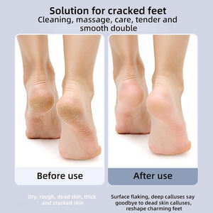 طاحونة القدم الكهربائية القابلة لإعادة الشحن مزيل الكالس المحمولة اللاسلكية للسفر - Product Image 6