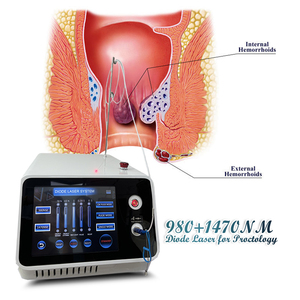 Máquina Láser Quirúrgica con Certificación CE para Proctología, Hemorroides, 980nm 1470nm, <span class=keywords><strong>Proctoscopia</strong></span>, Cirugía de Fisuras, para Várices - Product Image 6