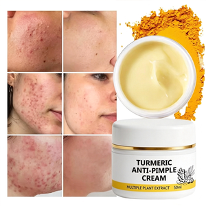 Creme Facial Personalizado com Logo de Cúrcuma e Vitamina C para Acne, Remoção de Manchas Escuras e Marcas de Acne, Suavização de Espinhas e Clareamento para Todos os Tipos de Pele - Product Image 2