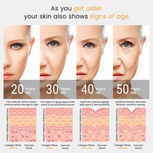 เครื่องนวดหน้าสปาที่บ้าน 4 in 1 พร้อมหัวอิเล็กโทรดความถี่สูงและหลอดแก้วสำหรับอิเล็กโทรเทอราปี - Product Image 3