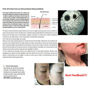 Juego de exfoliación de algas Biomicroneedling Spongilla Spicules Mascarilla exfoliante de algas naturales en polvo Peeling facial biológico/Acné B - Product Image 5