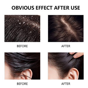 Trattamento Esfoliante Antiforfora a Marchio Privato, Purifica e Leviga i Capelli, Scrub Vegano per il Cuoio Capelluto - Product Image 3