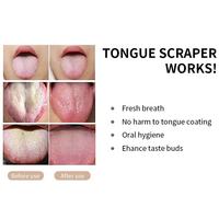 Nettoyeur de langue en forme de U personnalisé en usine brosse de nettoyage de soins bucco-dentaires en acier inoxydable réduire la mauvaise haleine grattoir de langue avec boîte-cadeau