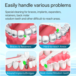 Compatible con cabezales de cepillo de dientes eléctrico/USB <span class=keywords><strong>Oral</strong></span>-<span class=keywords><strong>B</strong></span> <span class=keywords><strong>IO</strong></span> para una eliminación profunda de la placa bacteriana con cerdas retorcidas. - Product Image 6