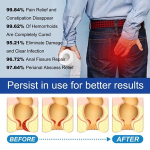 Pomada OEM para Hemorroides Original a Base de Hierbas Crema para el Dolor de Hemorroides y Fisuras <span class=keywords><strong>Anales</strong></span> - Product Image 3