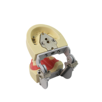 Modelo de estudio dental de dientes primarios infantiles con encía blanda y articulador FE
