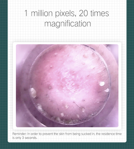 PAKISS Thiết Bị Làm Sạch Da Máy Làm Sạch Lỗ Chân Lông Máy Hút Mụn Đầu Đen Có Thể Nhìn Thấy Máy Làm Sạch Mặt Mụn Đầu Đen - Product Image 4