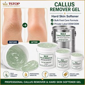 Crema <span class=keywords><strong>para</strong></span> Pies Diabéticos, Bálsamo Calmante <span class=keywords><strong>para</strong></span> Piel Seca y Áspera, Crema <span class=keywords><strong>para</strong></span> Pies Agrietados, Fórmula Antifúngica, Base de Fórmula Estándar - Product Image 1
