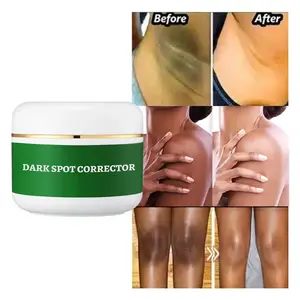Crème éclaircissante pour les taches sombres en 7 jours, correcteur puissant, <span class=keywords><strong>acide</strong></span> <span class=keywords><strong>hyaluronique</strong></span>, <span class=keywords><strong>vitamine</strong></span> <span class=keywords><strong>C</strong></span> pour tous les types <span class=keywords><strong>de</strong></span> peau - Lotion pour le visage en marque privée - Product Image 3