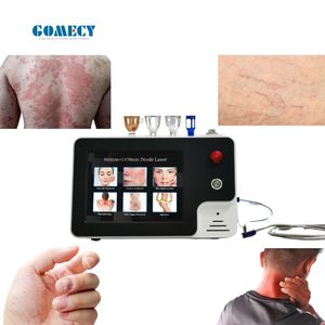 عروض ترويجية ساخنة: جهاز GOMECY Class 980 1470 للعلاج بالليزر 980 نانومتر للفطريات والأظافر والبواسير - Product Image 6