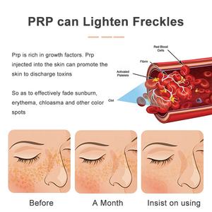 Tube PRP avec kit complet de solutions pour la correction des poils du visage - Product Image 5