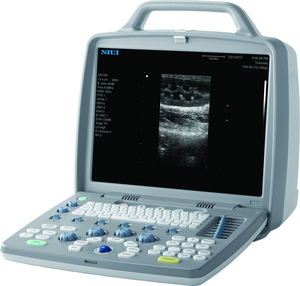 Ecógrafo Portátil Digital en Blanco y Negro SIUI CTS-6600 con Monitor de 15 Pulgadas para Clínicas Veterinarias y Trabajos de Campo - Product Image 3