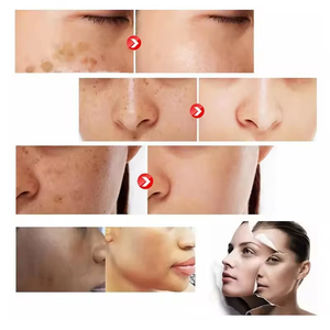 Kapsul Vitamin C pemutih kulit, kapsul Vitamin C pemutih kulit kolagen laut Anti Penuaan, kapsul suplemen Softgel pemutih kulit - Product Image 2