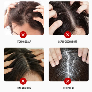 Loción de Alquitrán de Carbón Natural con Fórmula Herbal para el Cuidado del Cabello, Alivia el Malestar del Cuero Cabelludo, Reduce <span class=keywords><strong>la</strong></span> Picazón y Trata el Tricodermatitis - Product Image 4