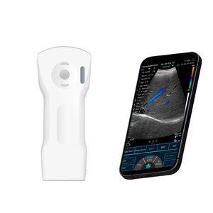 Ecografo Portatile Elettrico SURESULT D3Ultra per Imaging del Seno - Caratterizzazione delle Lesioni, Valutazione degli Impianti e Guida alla Biopsia - Product Image 6