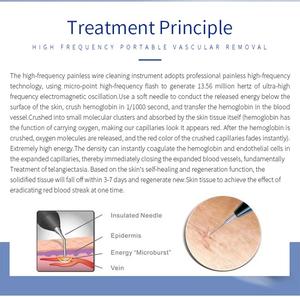 Máquina de eliminación de venas rojas y <span class=keywords><strong>arañas</strong></span> <span class=keywords><strong>vasculares</strong></span> RBS para uso doméstico, reducción vascular de sangre roja de 980nm, <span class=keywords><strong>precio</strong></span>. - Product Image 6