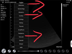 <span class=keywords><strong>Machine</strong></span> à ultrasons portable sans fil à ultrasons Konted MDR Gen5 Palm 3 en 1 sonde unique multifonctionnelle pour tout le corps - Product Image 3