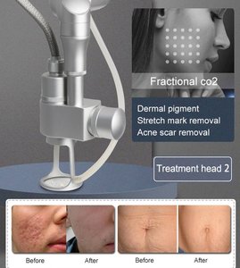 Dispositivo Láser Fraccional de CO2 Más Vendido para Eliminación de Cicatrices, Rejuvenecimiento Vaginal y de la Piel, Máquina de Sistema de CO2, Cepillo de Limpieza Facial - Product Image 4