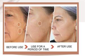 <span class=keywords><strong>Meilleure</strong></span> <span class=keywords><strong>crème</strong></span> éclaircissante au glutathion <span class=keywords><strong>Crème</strong></span> hydratante anti-âge blanchissante <span class=keywords><strong>pour</strong></span> <span class=keywords><strong>la</strong></span> peau sèche et sensible, <span class=keywords><strong>rides</strong></span> - Product Image 4