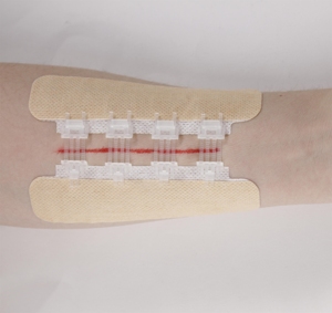 Dispositivo Médico para Cierre de Heridas, Adhesivo Quirúrgico Zip Stitch, Cierre con Cremallera, Desinfección por Infrarrojos Lejanos, Certificado CE Clase I Liderson PZF1006 - Product Image 4