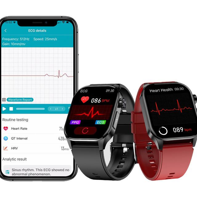 ET580 ECG  Smart Health Watches AI Medical Diagnosis Waterproof Smart Watch ultra Breathing Training Relojes Smart Watch for Men