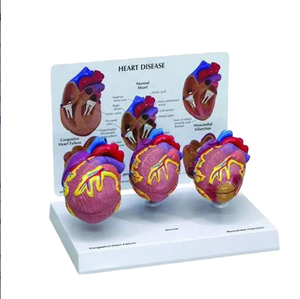 Modello di Cuore Patologico, Modello Anatomico del Cuore Umano, Modello Didattico per Patologia Cardiaca, Certificato CE ROHS ISO CNAS - Product Image 2