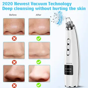 2020 5 1 프로브 깊은 얼굴 피부 청소 Usb 충전식 전기 모공 청소기 진공 여드름 리무버 여성과 남성