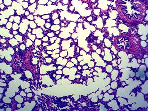 निर्माता मानव पैथोलॉजी अनुभाग स्लाइड 100 मानव स्थानीय सूजन माइक्रोस्कोप उपकरण के टुकड़ों का उत्पादन करते हैं - Product Image 6