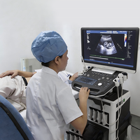 Système d'échographie cardiaque vétérinaire avec échographie Doppler couleur PW CW et imagerie Doppler tissulaire