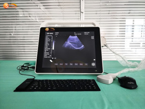 Instrumentos de Ultrasonido Médico de 15 Pulgadas, Precio Más Bajo, Ultrasonido Portátil con Pantalla Táctil Tipo Tablet - Product Image 2