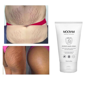 Crème réparatrice pour la peau des femmes, lotion privée, bio, <span class=keywords><strong>meilleure</strong></span> vente, <span class=keywords><strong>anti</strong></span>-<span class=keywords><strong>grossesse</strong></span>, suppression des cicatrices extensibles, à la mode - Product Image 4