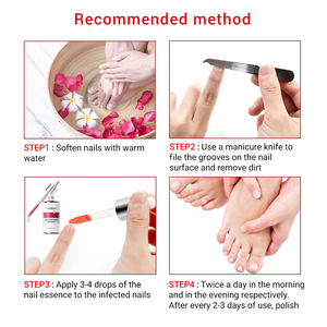LANBENA Essence pour les ongles des pieds, gel réparateur pour les soins des ongles, onychomycose - Product Image 2