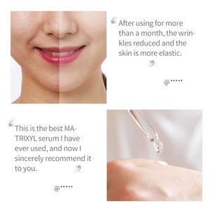 Siero Viso 15ml alla Camomilla con Vitamina B e C e Acido Ialuronico, Idratante, Illuminante, Riducente dei Pori, Trattamento Rivitalizzante per la Pelle - Product Image 5