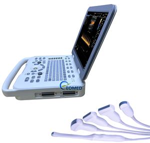 बहु-मोड स्कैनिंग और अनुकूलन भाषा समर्थन रंग डॉपलर सिस्टम पशु चिकित्सा मानव इको CU20-2 - Product Image 3