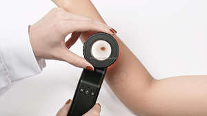 KTMED KT-P088 Instrument Dermatologique <span class=keywords><strong>Dermatoscope</strong></span> Corps Métallique Polarisé et Non Polarisé Dermatoscopio Numérique - Product Image 6