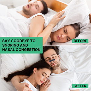 Cerotti Nasali Sportivi Personalizzati di Qualità Europea, Strisce Nasali, Nastri Nasali, Cerotti Nasali - Product Image 5