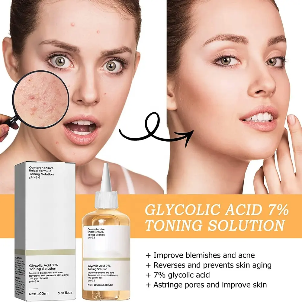 Glycolic Sour 7% Toning Resurfacing Solução para manchas e Acne Esfoliação Facial Astringe Poros Ácido Glicólico 7% Toner