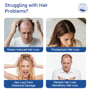 Aceite Esencial Natural Orgánico de Romero y Arborvitae para el Crecimiento del Cabello, Aceite para Masaje del Cuero Cabelludo, Suero Anticaída para Hombres y Mujeres - Product Image 3