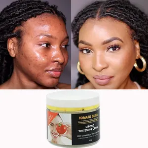 Crème de beauté anti-taches noires pour le visage Crème hydratante nourrissante à la tomate Crème blanchissante pour l'élimination des taches brunes