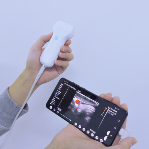 Nuevos instrumentos analíticos clínicos de alta calidad, inalámbricos y Usb, matriz lineal, sonda de ultrasonido Doppler a Color, Konted C10UL - Product Image 5