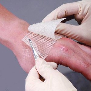 Gaze stérile en <span class=keywords><strong>tulle</strong></span> et paraffine pour pansements, gaze à la vaseline pour pansements septiques - Product Image 3