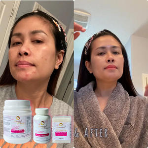 Handelsmarken-Kollagen peptid pulver Malaysia Marine kollagen mit Hyaluronsäure-Kollagen pulver - Product Image 2